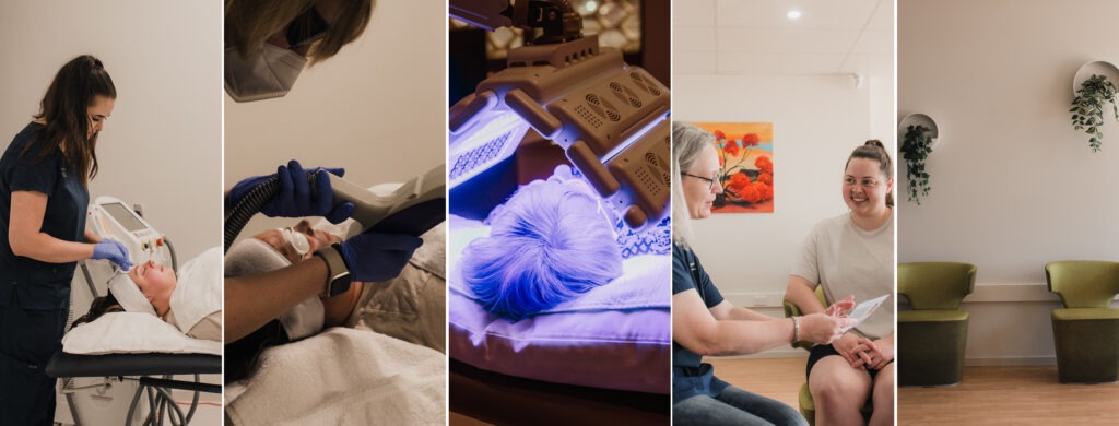 Skin Rejuvenation | About You Clinic